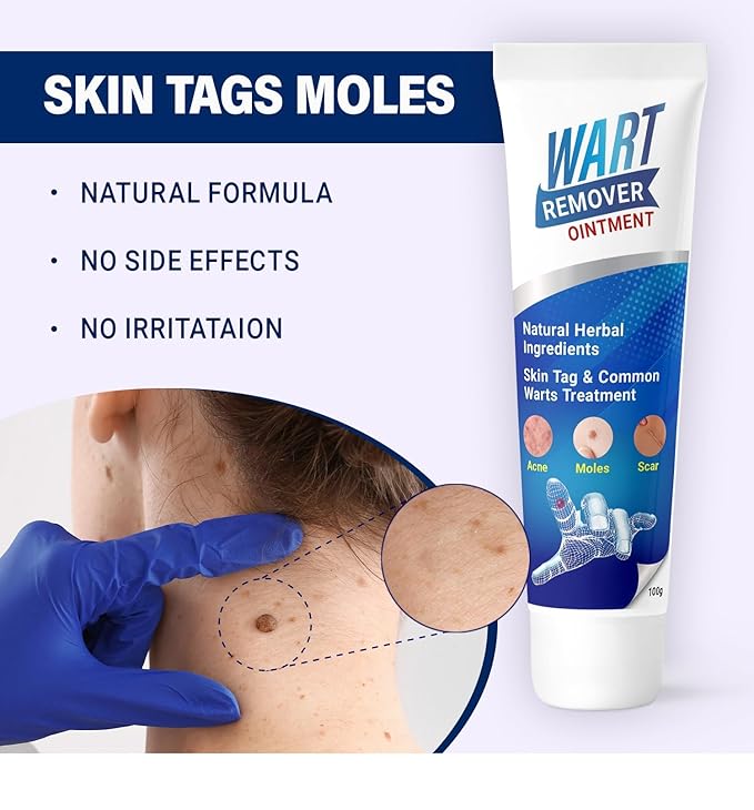 Wart Remover Instant Blemish Cream