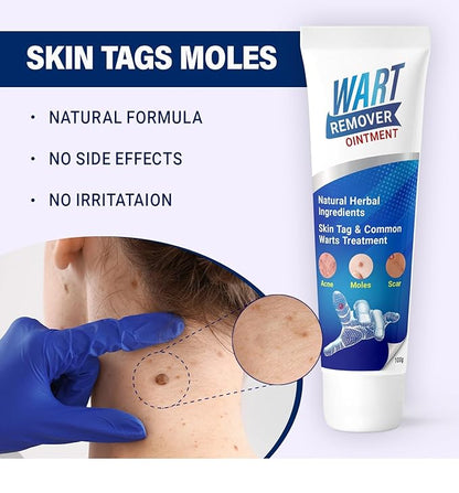 Wart Remover Instant Blemish Cream